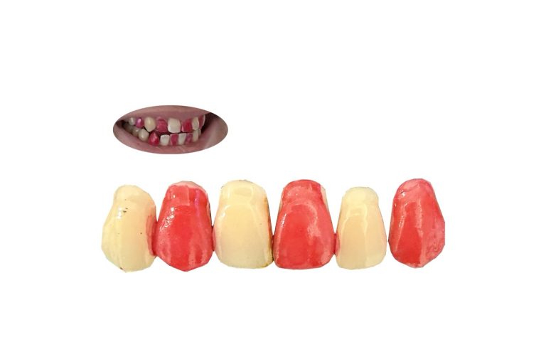 歯を赤にメイクする、新しい表現。“赤と白の対比”で口元にパターンをつくる歯の化粧品を新発売！